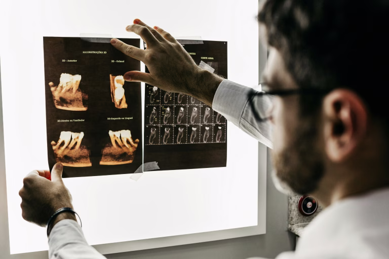 How Long Do Dental Implants Last? What the Research Says