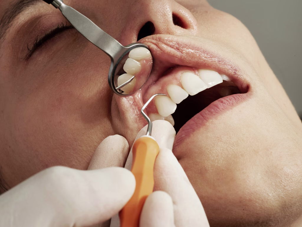 Same-Day Teeth: How the Immediate Load Implant Process Works